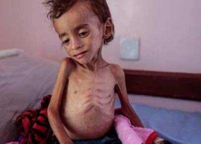 خطر مرگ جمعی در کمین میلیون ها کودک یمنی